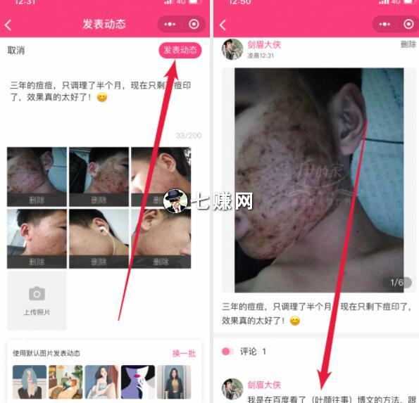 怎么挖同行粉丝墙角引流?小程序案例!